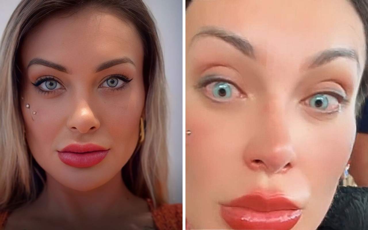 Andressa Urach relata dores intensas após cirurgia para mudar a cor dos olhos e diz estar “quase arrependida”